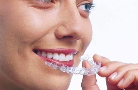 Adult Braces in Kingston