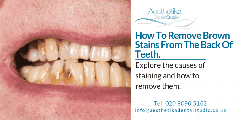 Remove Brown Stains From Teeth Kingston Aesthetika