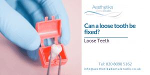 Can a Loose Tooth Be Fixed