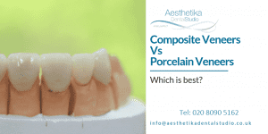 Composite Dental Veneers Kingston