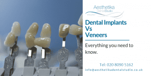 Dental Implants vs Veneers Kingston Aesthetika Dental