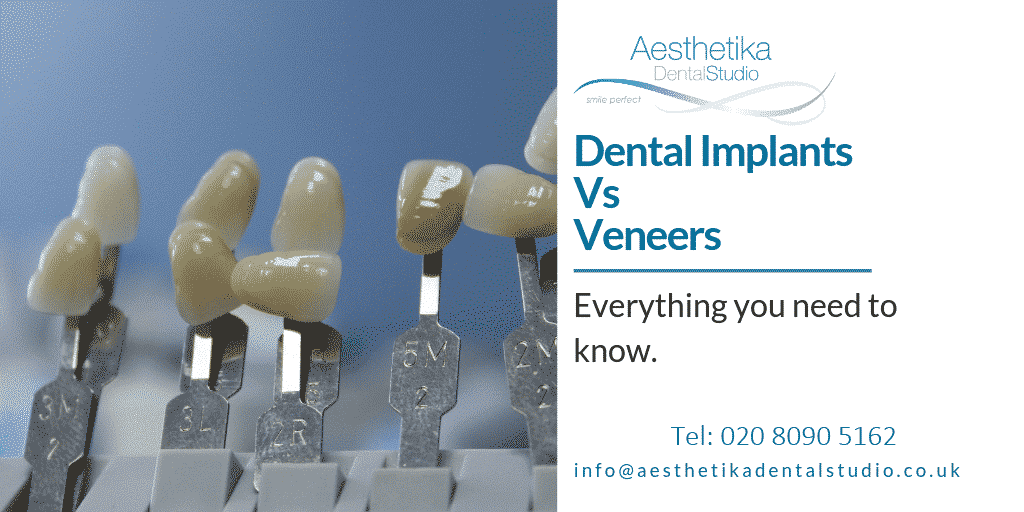 Dental Implants vs Veneers Kingston Aesthetika Dental