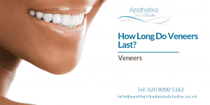 How Long Do Veneers Last