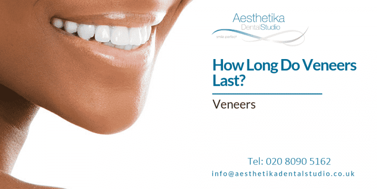 How Long Do Veneers Last