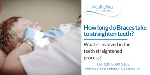 How Long to Straighten Teeth Aesthetika Dental Studio