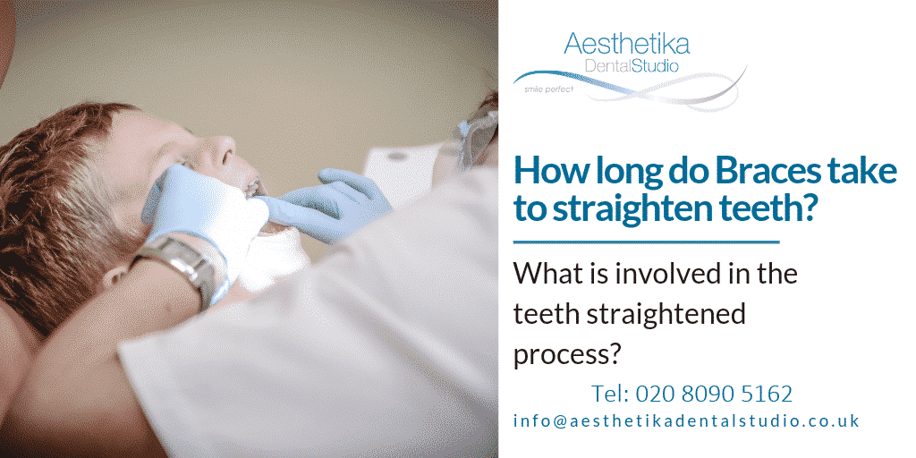 How Long to Straighten Teeth Aesthetika Dental Studio