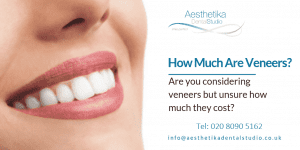 Cost of Dental Veneers