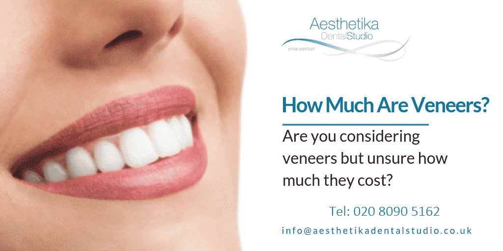 Cost of Dental Veneers