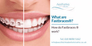 What Are Fastbraces Aesthetika Dental Studio