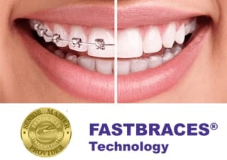 Fastbraces options Kingston