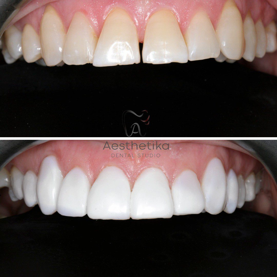 Cosmetic-Dentist-Aesthetika-11