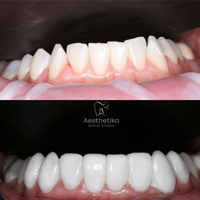 Cosmetic-Dentist-Aesthetika-19