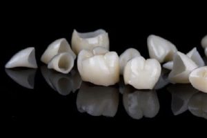 Loose Dental Crowns Treated by Dentist